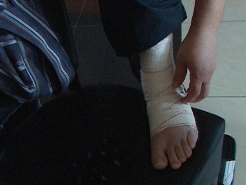 Vytkli ste si členok? Ak počujete tento zvuk, určite sa neliečte sami!