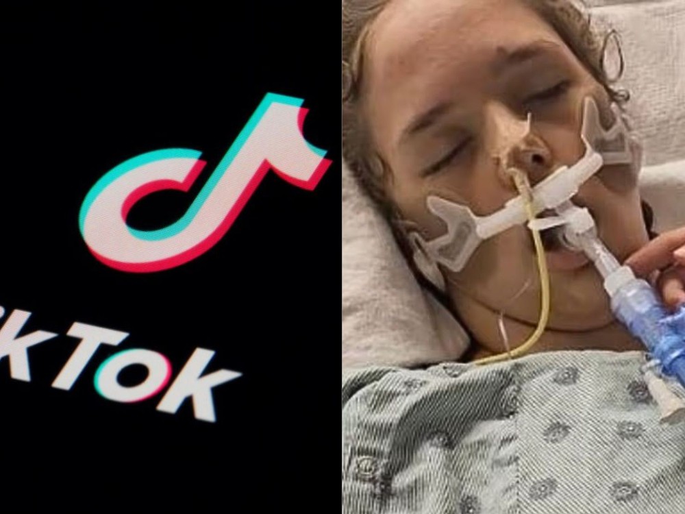 Tínedžerka utrpela po virálnej výzve mozgovú smrť. Chcela byť slávna na TikToku