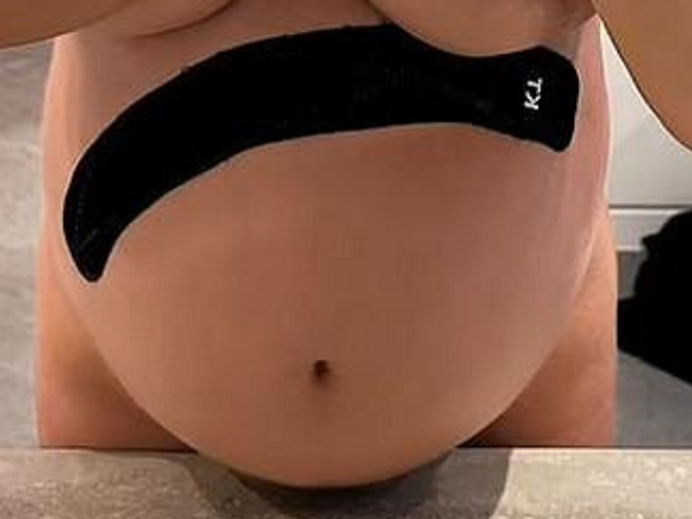 Ukázala poriadne bruško ÚPLNE nahá! Chcela vraj len pochváliť prácu chiropraktika!