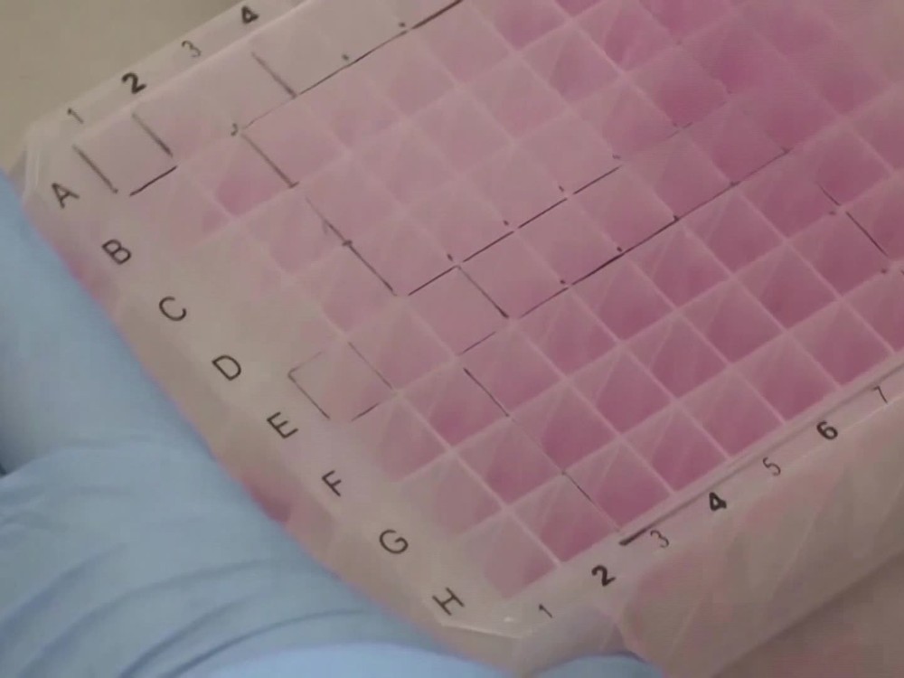 Na Slovensku potvrdili 5 prípadov opičích kiahní