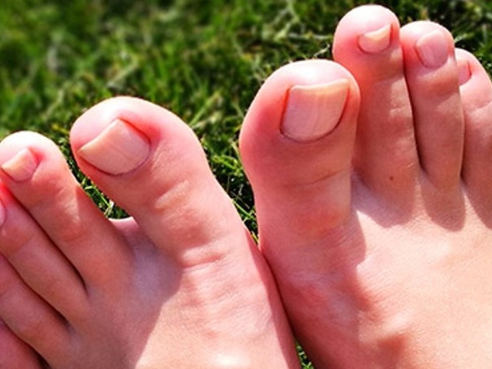 Vysoký cholesterol sa prejaví aj na nohách!  Všímajte si týchto 7 príznakov