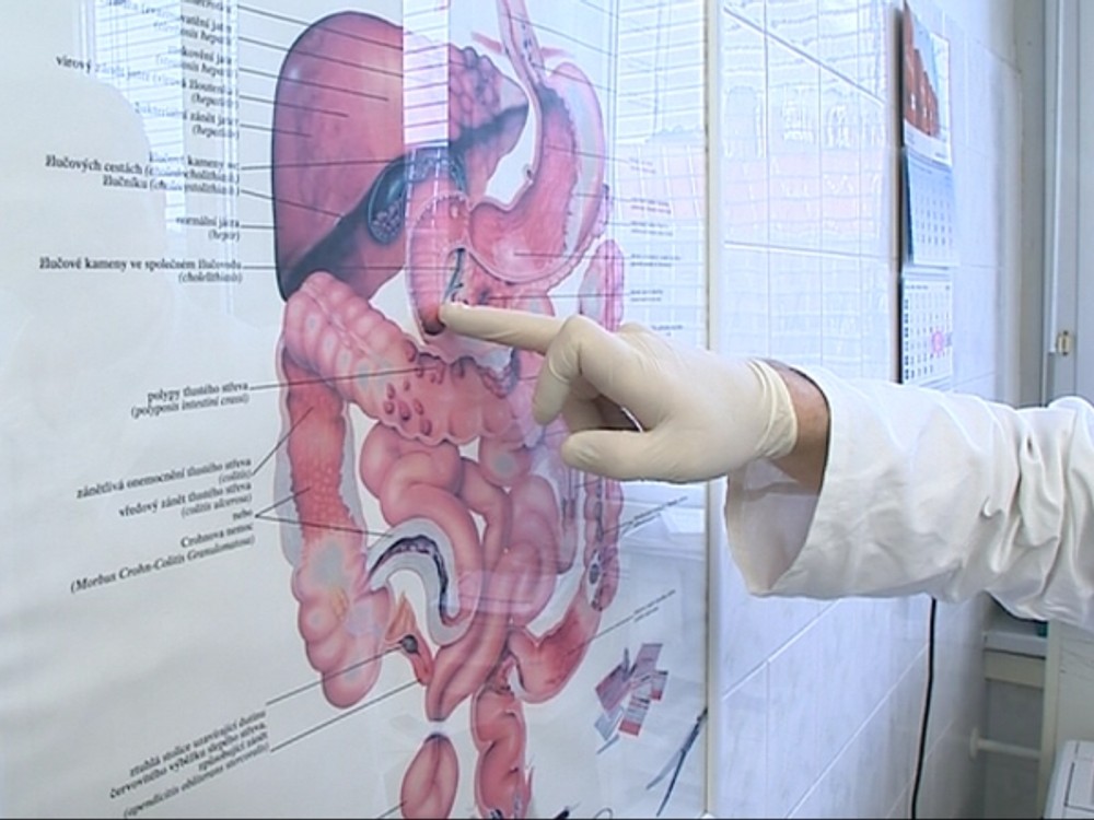 Až 40 percent Slovákov trpí touto nákazou: Máte aj vy INFEKCIU, KTORÁ NIČÍ TRÁVENIE?