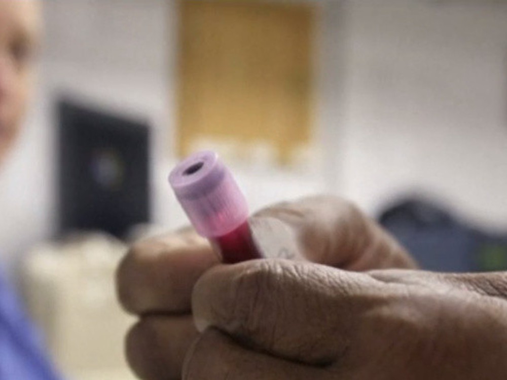 TIETO 3 faktory spôsobujú až polovicu úmrtí na rakovinu: Odstrániť ich môže každý!