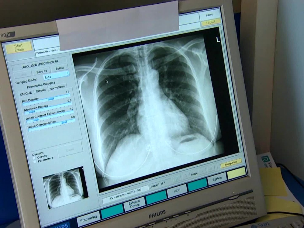 13 ochorení, ktoré ohrozujú vaše pľúca: Čo robiť, ak sa vám ťažko dýcha?