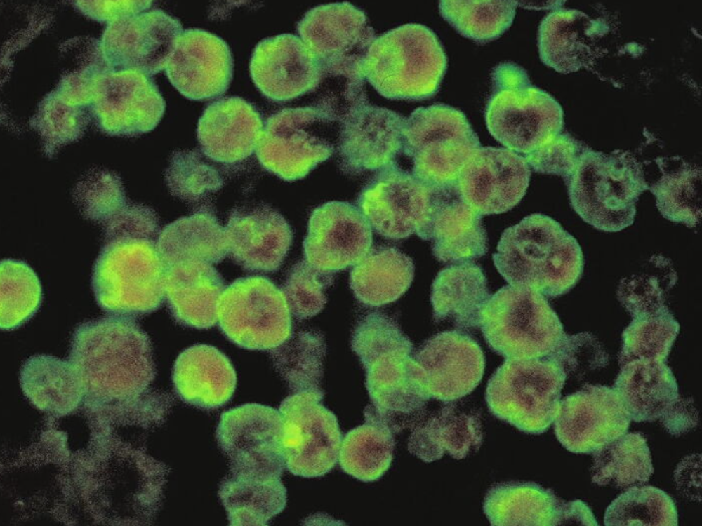 Vo vzorkách z kúpaliska Vadaš hygienici nepotvrdili prítomnosť améby Naegleria fowleri