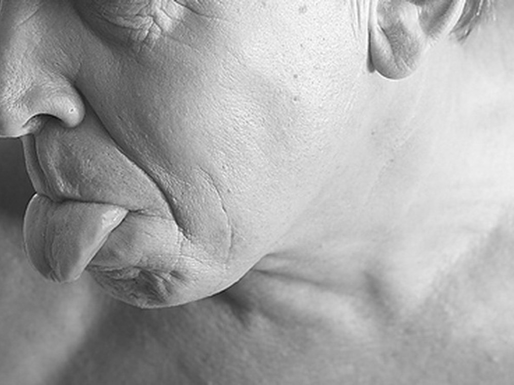 Lekár o nádoroch hlavy a krku: Naši pacienti chodia neskoro, TIETO príznaky si  všímajte!