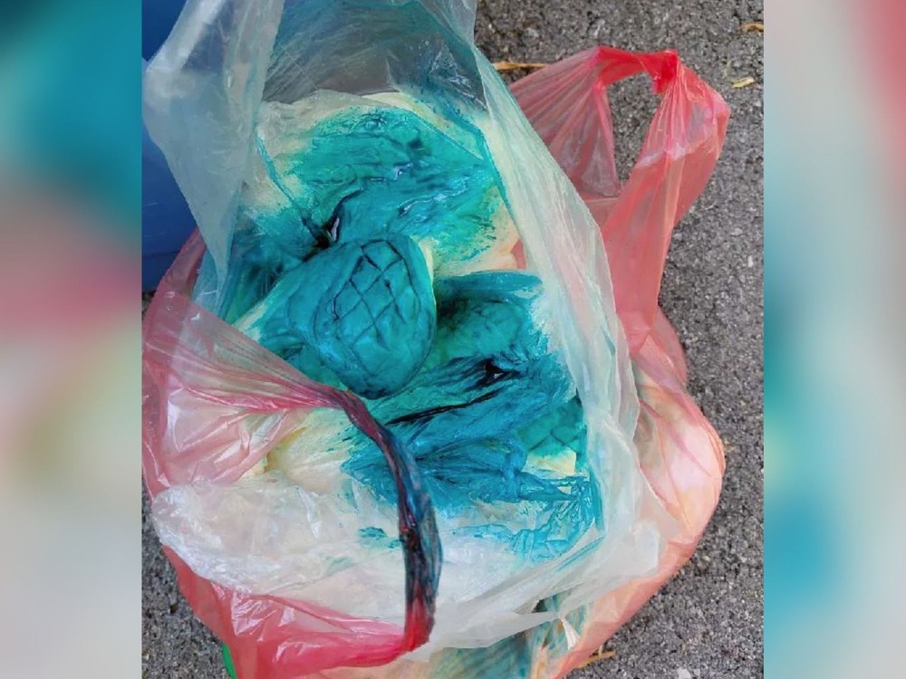 Na Slovensku zabíjala vážna infekcia! Listerióza ohrozuje najmä tehotné, chorých a deti
