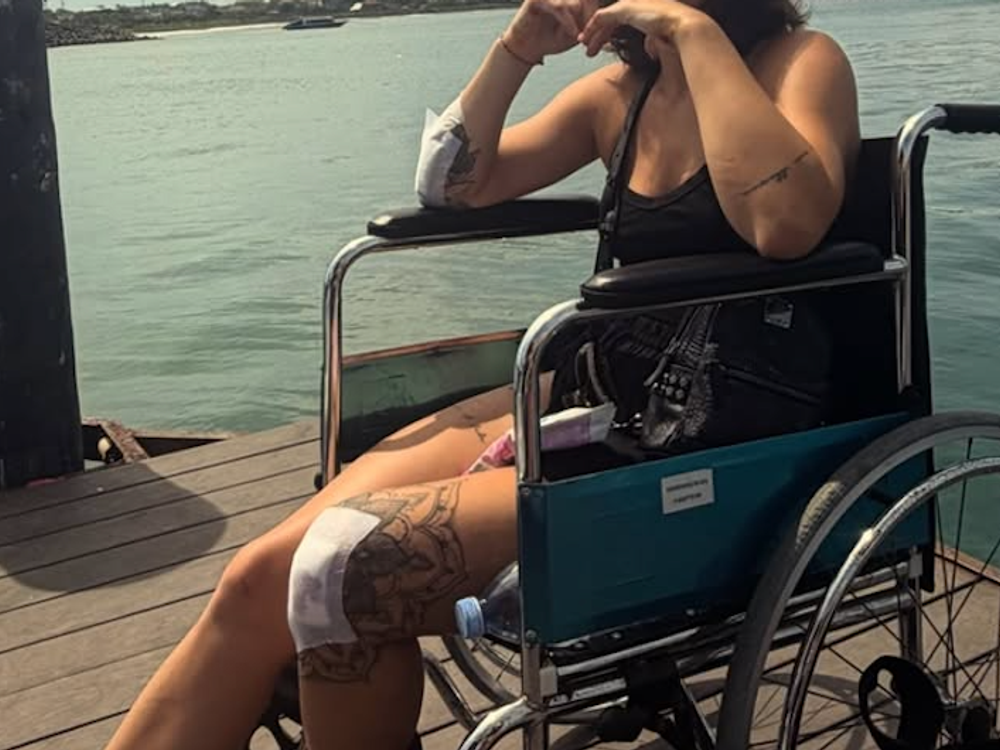 Hrozivé zábery z nehody slovenskej influencerky na Bali: TOTO jej zachránilo život!