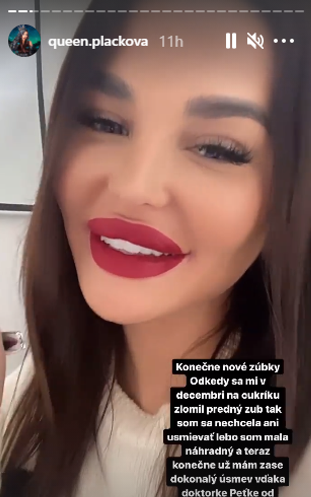plackova nové zuby