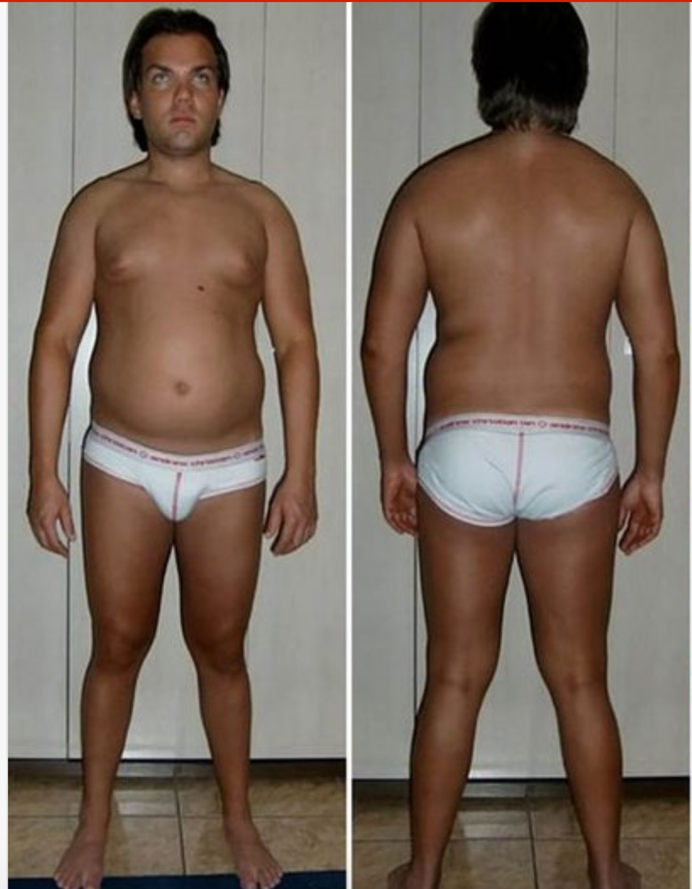 Rodrigo Alves pred plastikami