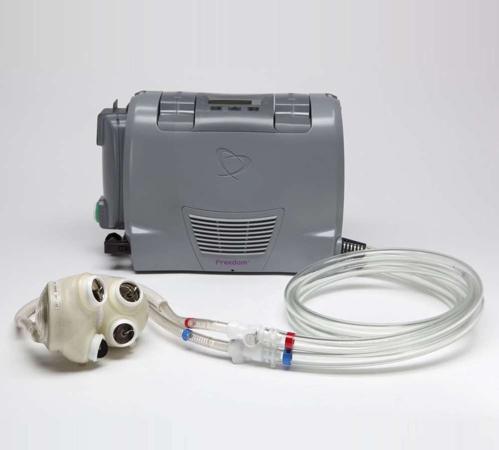 Prvý slovenský pacient s umelým srdcom je už aj po transplantácii srdca