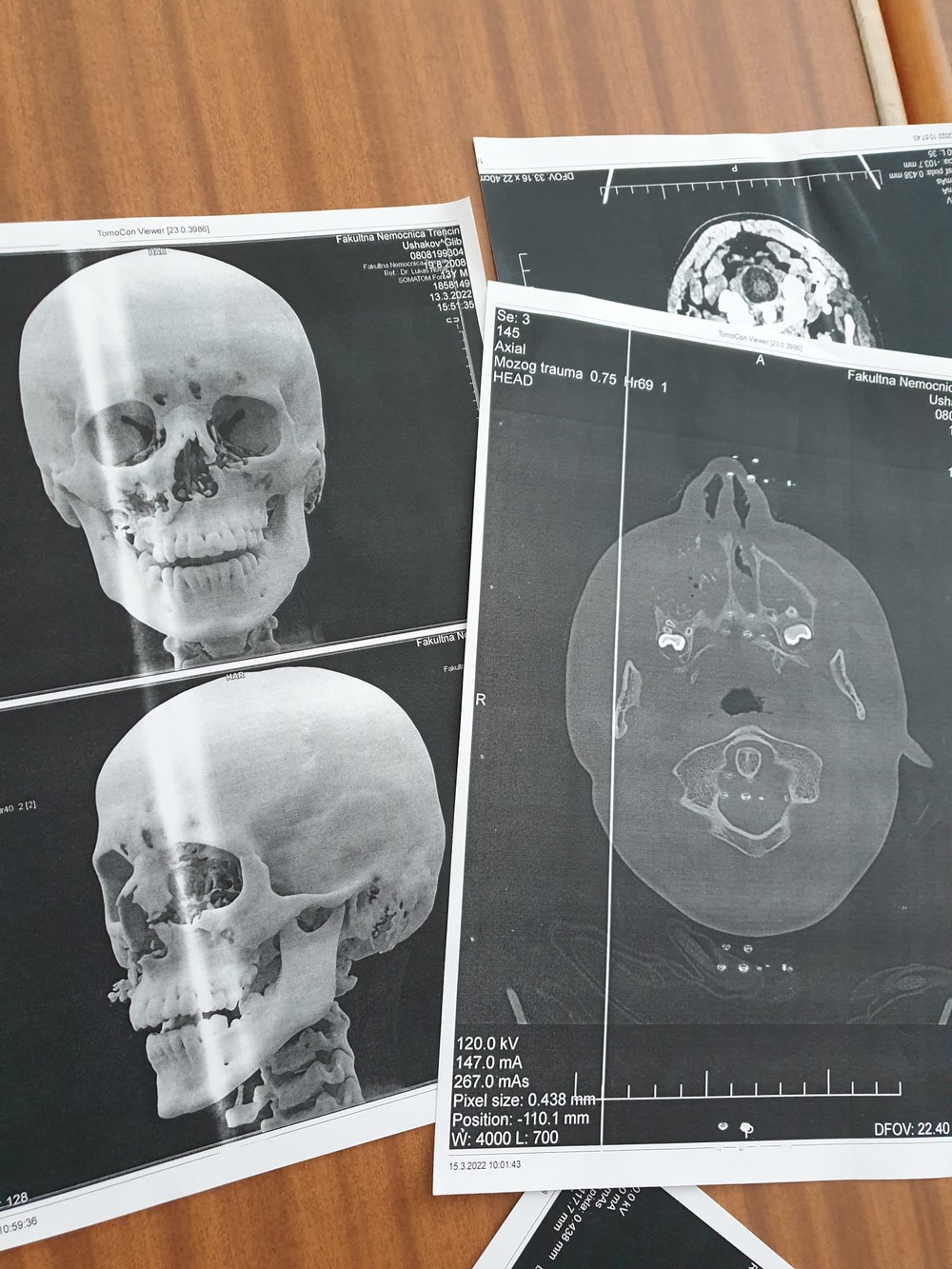 WhatsApp Image 2022-03-18 at 09.38.45