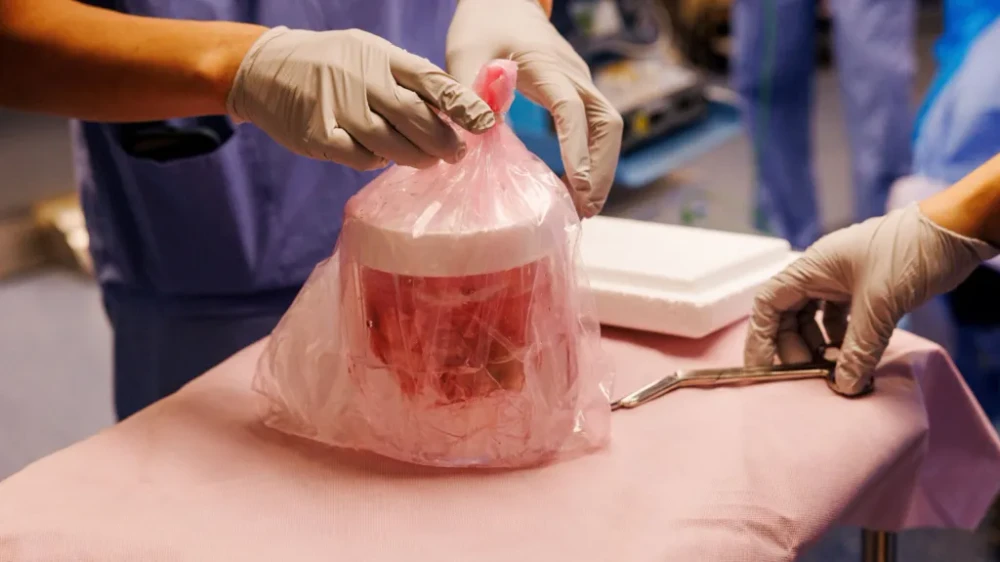 Xenotransplantácia