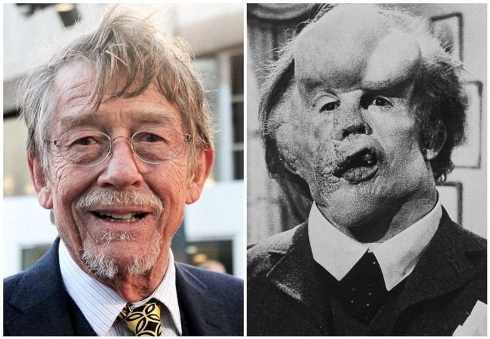 John Hurt - Sloní muž