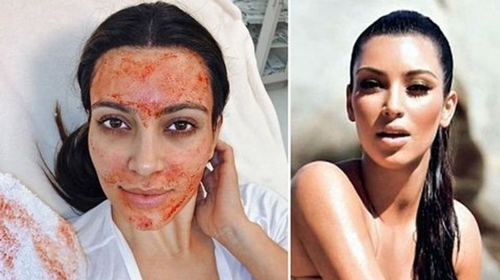 Kardashianky a ich rodina Kim Kardashian - plastiky 1