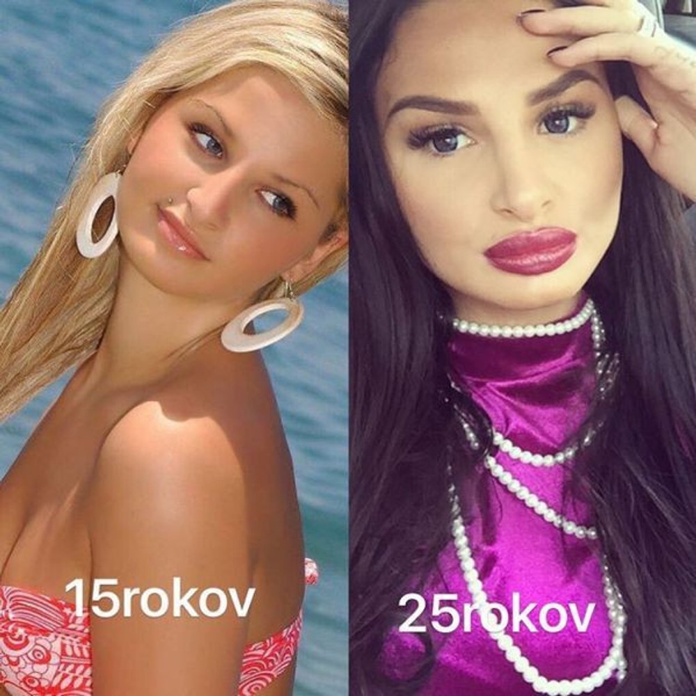 Zuzana Plačková v 15. rokoch