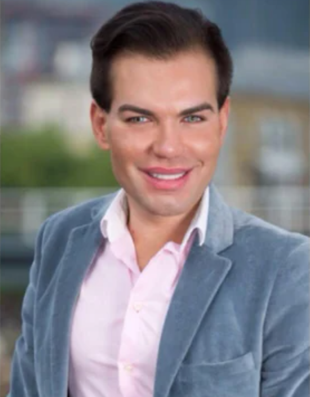 Rodrigo Alves pred plastikami