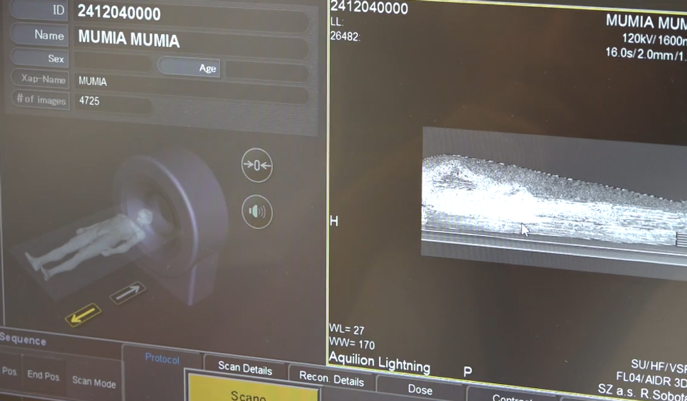 CT múmie 7