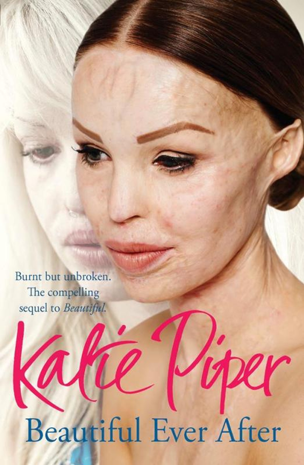 Katie Piper | Katie Piper- modelka obliata kyselinou