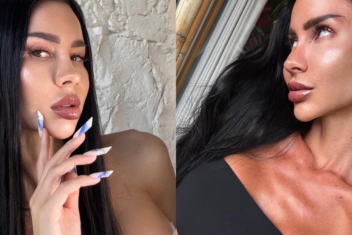 Jarka z Mama, ožeň ma: PRAVDA o jej estetických úpravách: ČO jej najviac zmenilo tvár?