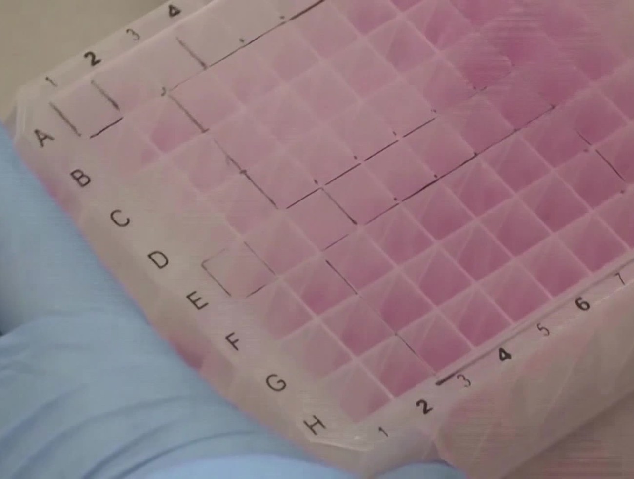 Na Slovensku potvrdili 5 prípadov opičích kiahní