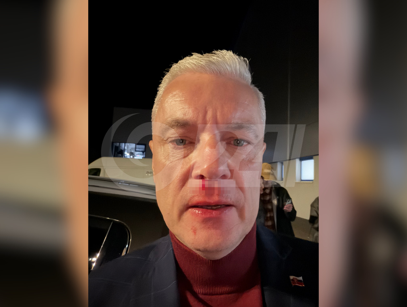 Ferenčák: Fyzicky ma napadli pred dcérou, skončil som na zemi, tiekla mi krv