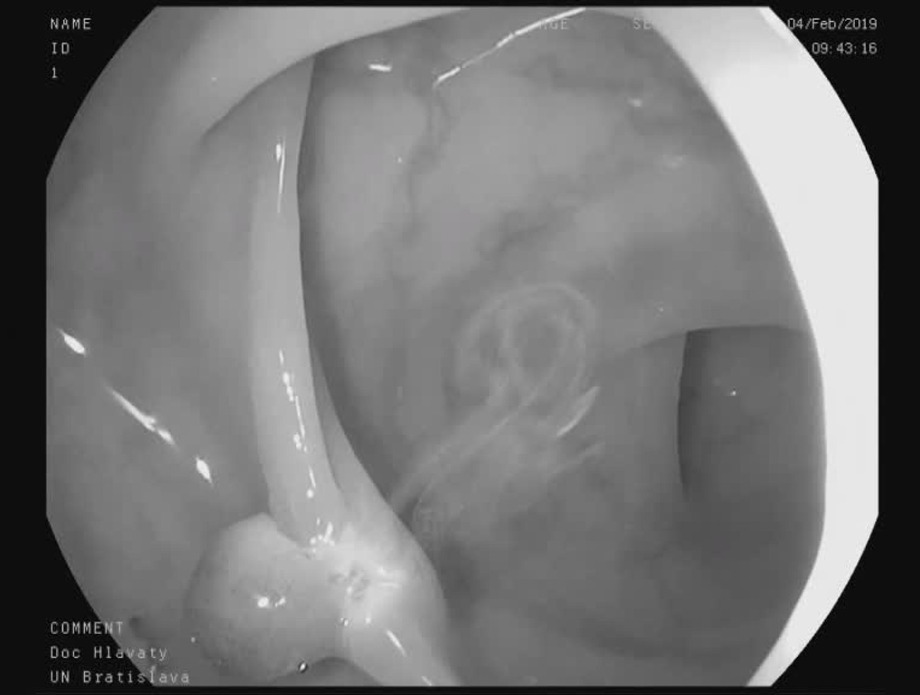 Vedci: Táto strava chráni až pred 5 druhmi rakovín, ale nie je bez rizika