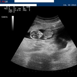 Andrej bude otcom! Na Facebooku ukázal fotky svojej priateľky a sono dieťaťa