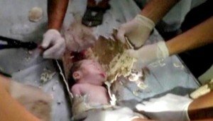 Chlapec v odpadovej rúre. Zachránil ho plač