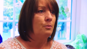 Strach zo zubára ju prinútil urobiť šialenú vec: Zničené zuby si doma lepila sekundovým lepidlom