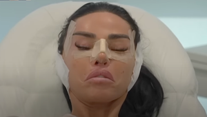 Vyzerám umelo a nechutne! Povedala sebakriticky kráska a rovno si opäť na plastike ľahla pod skalpel!