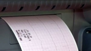 Ako spoznáte, že vám hrozí infarkt? Všímajte si týchto 11 príznakov!