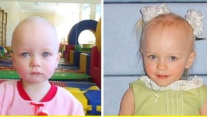 Dojemné fotografie adoptovaných detí: Takto ich zmenila milujúca rodina