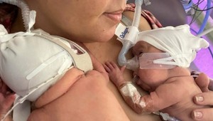 Najmenším predčasne narodeným dvojčatám nedávali šancu na prežitie: TAKTO vyzerajú dnes!