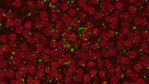 Zdroj nákazy Q horúčky v Ráztočne ešte nie je známy. Očakávajú ďalších nakazených