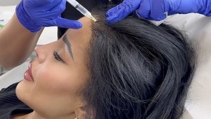 Influencerka je závislá na plastikách: Na jej vzhľade nie je prirodzené už asi nič