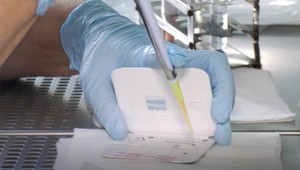 Chrípka ustupuje, hygienici ale upozorňujú na ťažké respiračné ochorenie