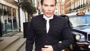 Živý Ken prišiel o rozum. Podstúpil najbizarnejšiu plastickú operáciu