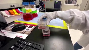 Za nežiadúcimi účinkami po očkovaní nemusí byť nutne očkovacia látka