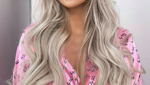 TOTO je slovenská kráľovná plastík: Spoznali by ste ju na fotkách z minulosti?