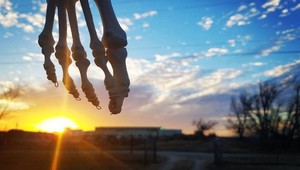 Rakovina jej vzala nohu. S kostrou končatiny cestuje po svete