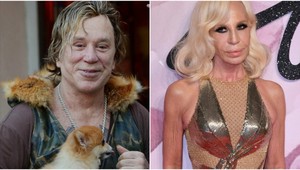 Najhoršie celebritné plastiky: Na tieto svetové hviezdy je dnes smutný pohľad