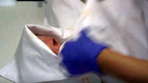 Elišku, ktorá sa narodila mame s mozgovou smrťou, si otec odviezol domov