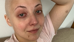 Rok bojuje s už druhou rakovinou. Anička Slováčková zverejnila fotky, aj trpkú pravdu!