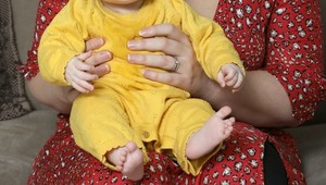 Už na ultrazvuku bolo vidieť, že bude iné: Vzhľad bábätka prekvapil rodičov aj lekárov