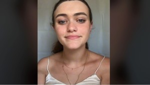 Emma si prestala umývať vlasy: Neuveriteľné, ako vyzerajú po 100 dňoch bez šampónu