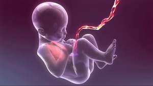 Naša pupočníková krv pomáha Američanom!