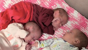 Prírodný unikát. V Košiciach prišli na svet jednovaječné TROJIČKY