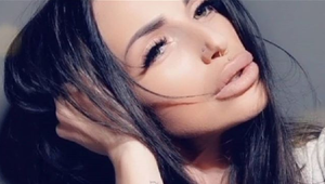 Bola na ďalšej plastike? Sexica Zuzanita šokovala úplne zmenenou tvárou!