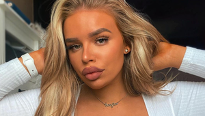 Na prvý pohľad vyzerá ako sexi Barbie: Keď uvidíte jej FOTKY z detstva, odpadnete